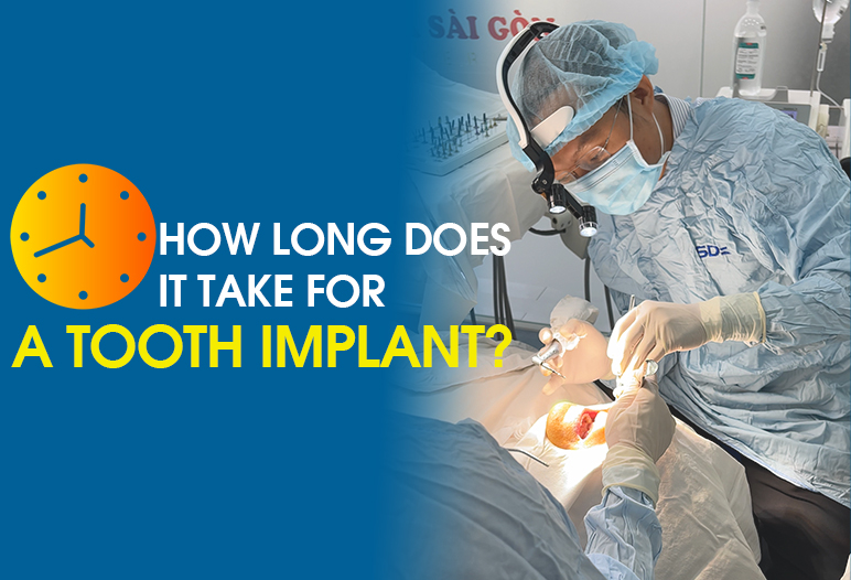 how long does a dental implant take