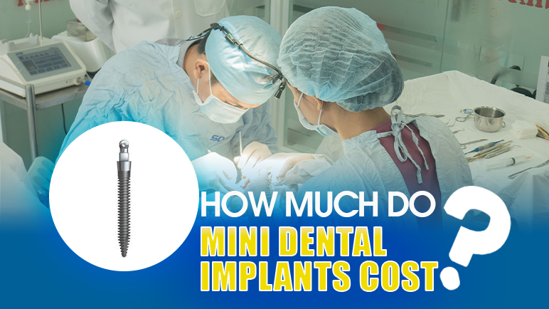 cost of mini implant dentures