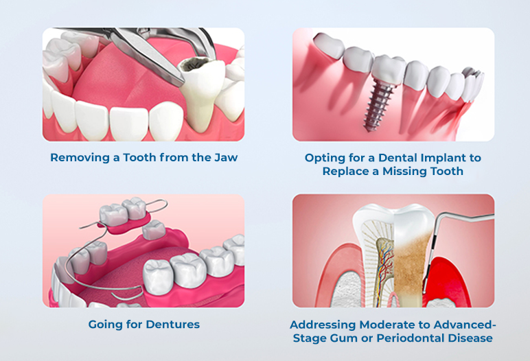 Preparation is key to the success of any dental bone grafting procedure