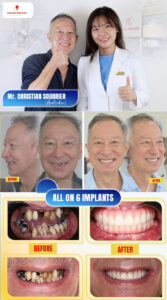 Specialist in Prosthodontics