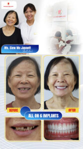 best dentist in ho chi minh city