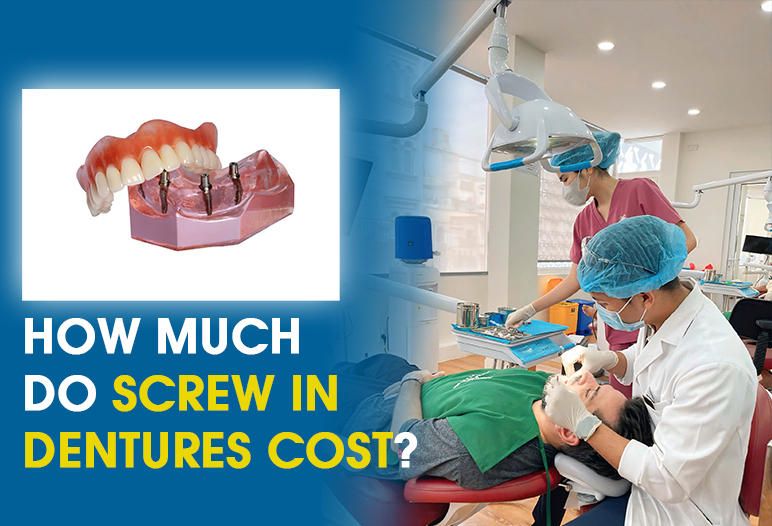 screw in dentures cost