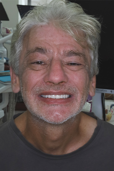 After image