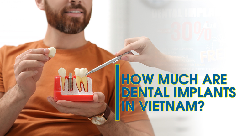 how much are dental implants in vietnam