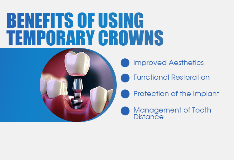 Benefits of using temporary crowns during the implant process