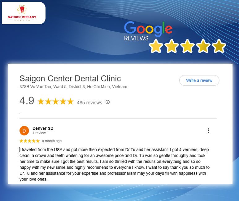 customer review