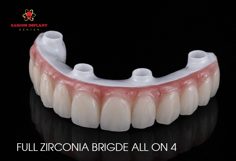 Full Zirconia Bridge All On 4 solid zirconia bridge all on 4
