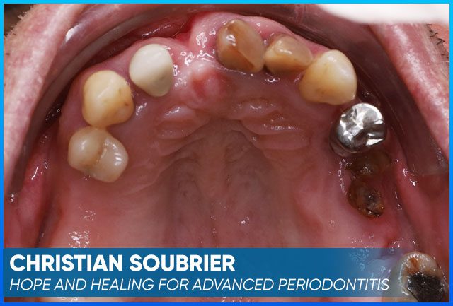 Christian Soubrier's picture case before