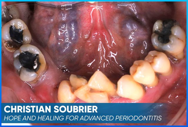 Christian Soubrier's picture case before
