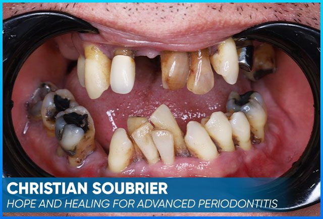Christian Soubrier's picture case before