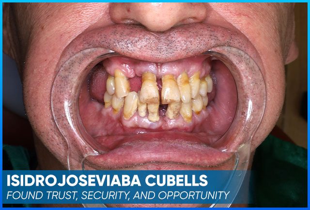 Isidrojoseviaba Cubells' case before procedure