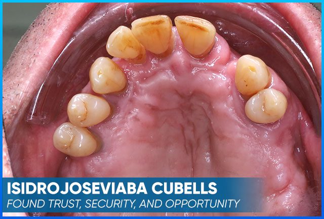 Isidrojoseviaba Cubells' case before procedure