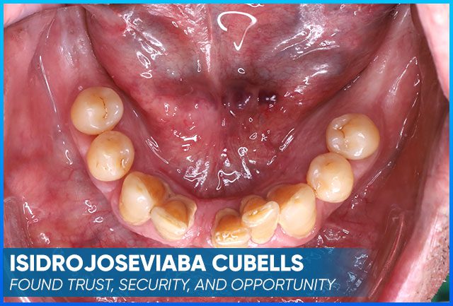 Isidrojoseviaba Cubells' case before procedure