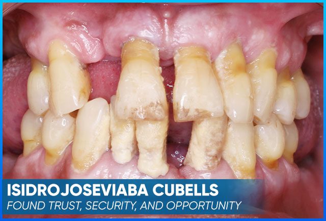 Isidrojoseviaba Cubells' case before procedure