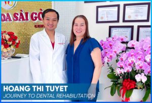 bs tan co tuyet