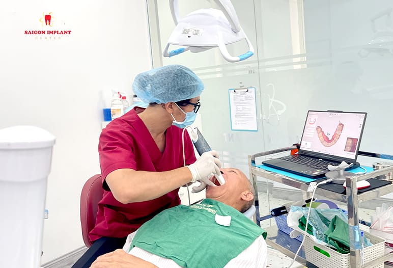 Intraoral scanning