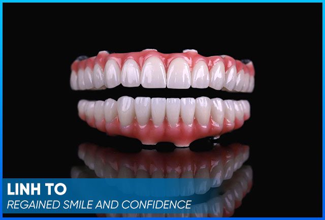Mrs Linh To's testimonial-style dental image