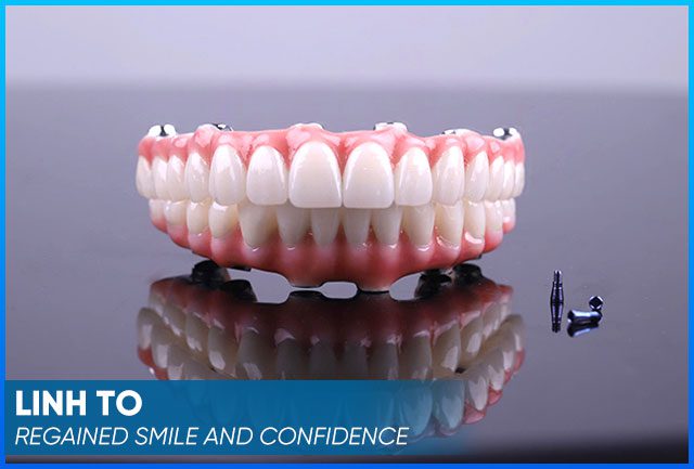 Mrs Linh To's testimonial-style dental image