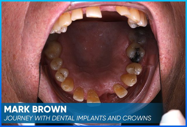 Mark Brown's case before