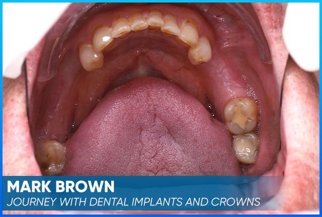 Mark Brown's case before