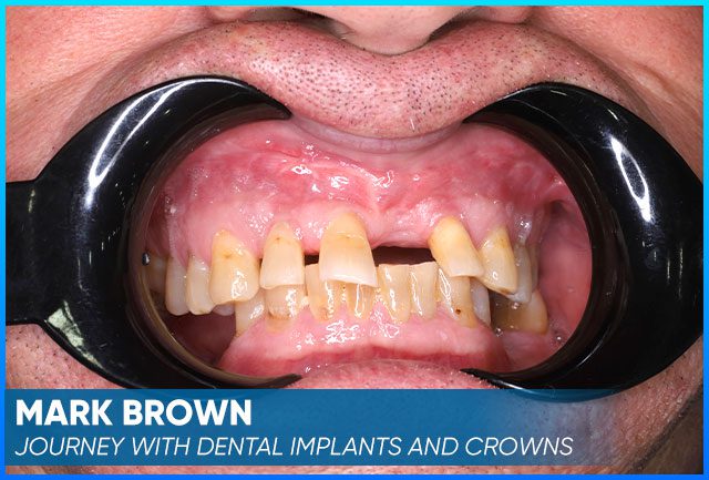 Mark Brown's case before