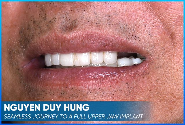 Nguyen Duy Hung's case before procedure