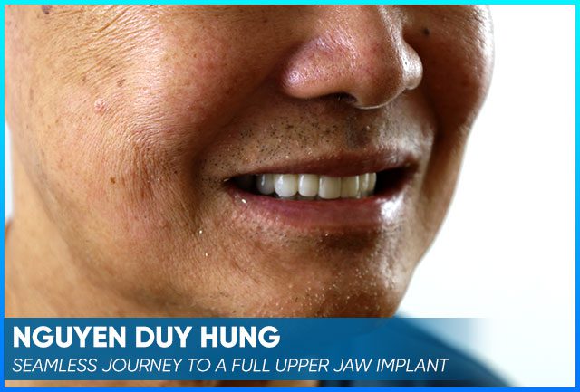 Nguyen Duy Hung's case before procedure