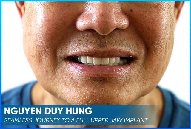 Nguyen Duy Hung's case before the procedure