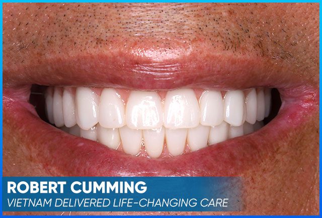 Case after the whole treatment