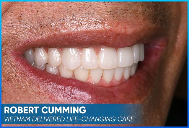 Case after the whole treatment