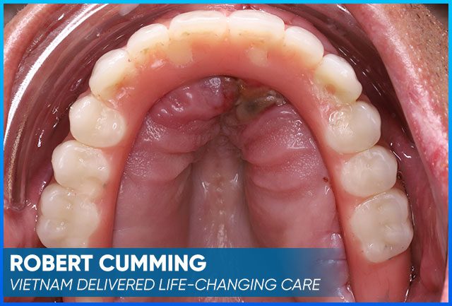 Case after the whole treatment