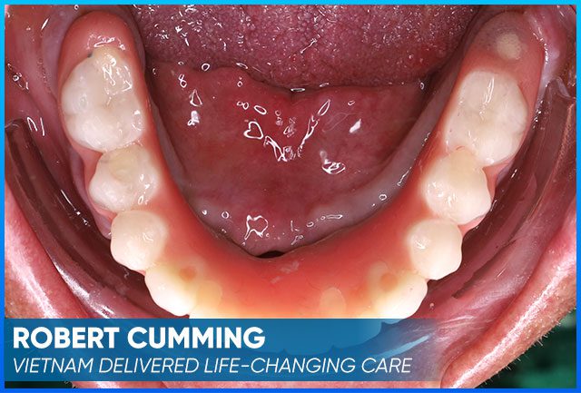 Case after the whole treatment