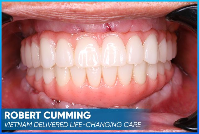 Case after the whole treatment