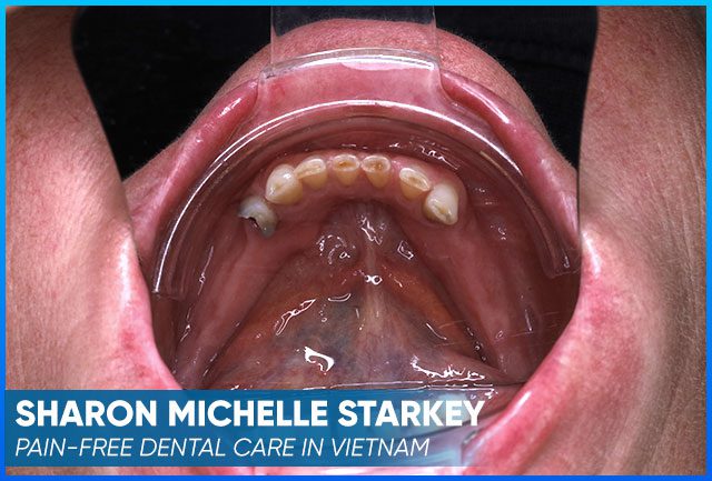 Sharon's case image before
