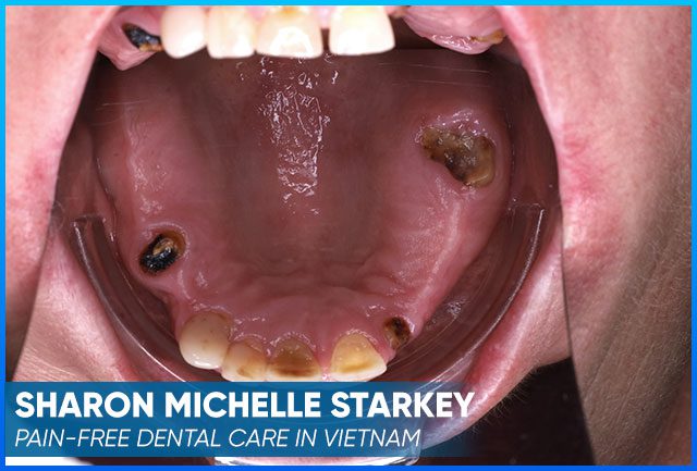 Sharon's case image before