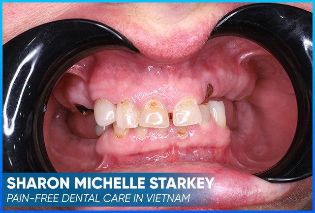 Sharon's case image before