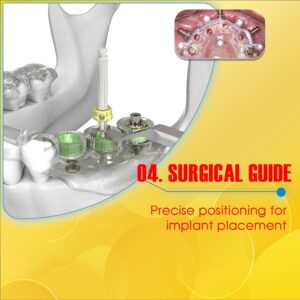 Prestigious dental implant clinic in Saigon 7