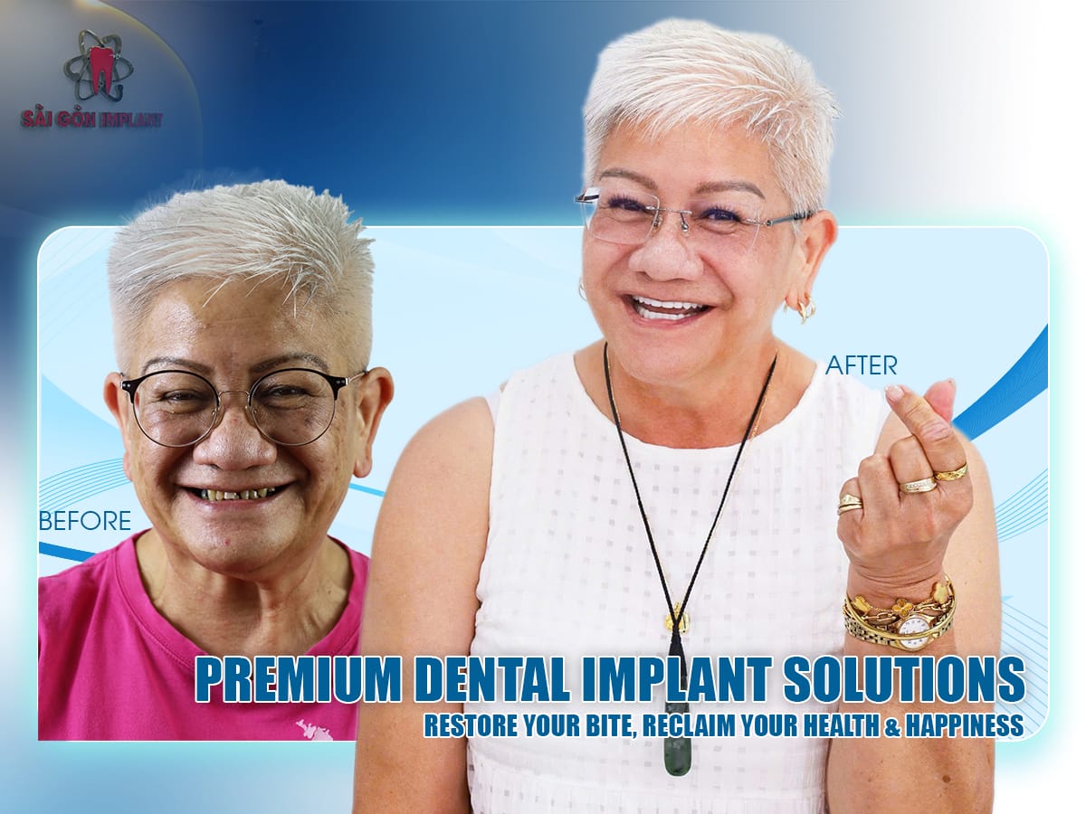 full mouth implant in ho chi minh vietnam all in one dental implant vietnam