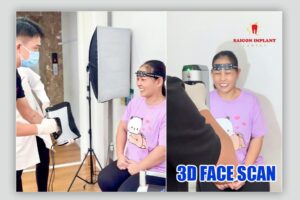 3D FACE SCAN
