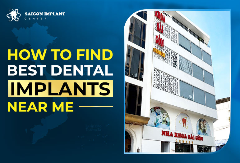 Best Dental Implant Near Me