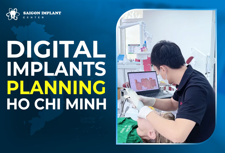 Digital implant planning Ho Chi Minh City