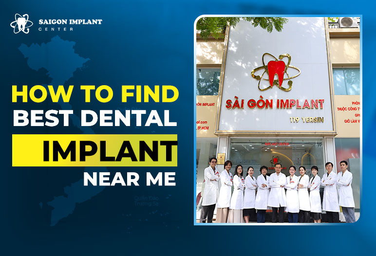 Best Dental Implant Near Me 1 best dental implant near me