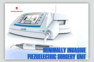 dental implant surgery