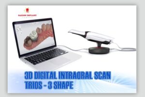 digital scaning