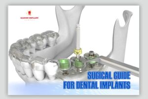 surgical guides