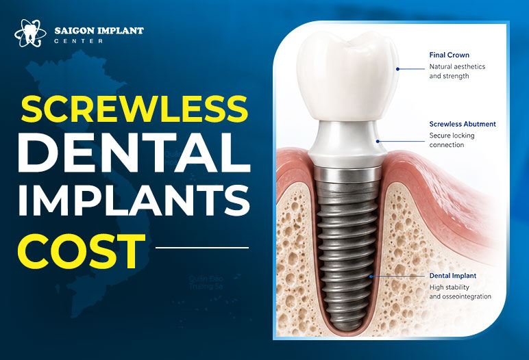screwless dental implants cost