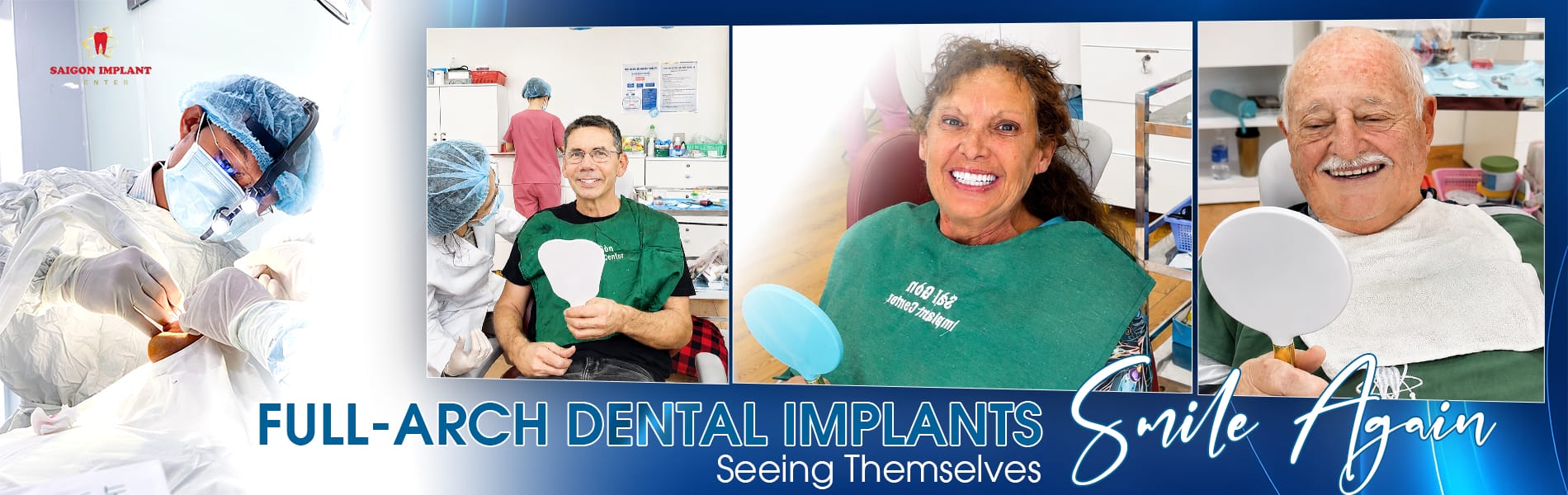 best all on 4 dental implant vietnam
