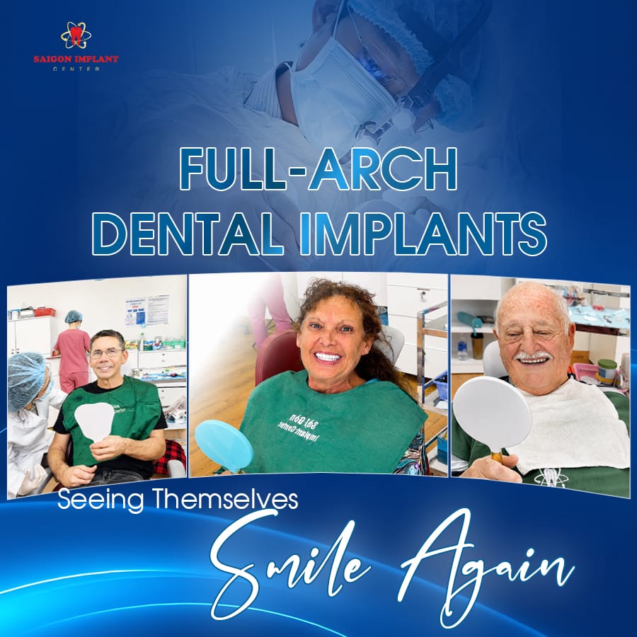 full arch all on 4 dental implants 1
