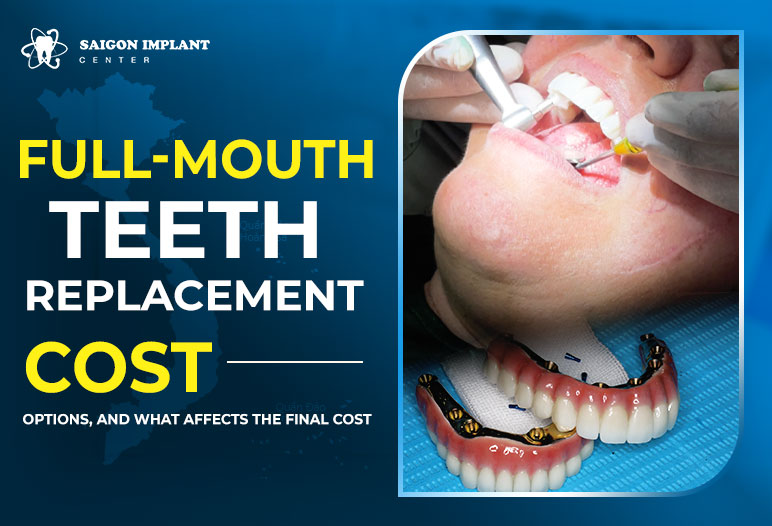 full mouth teeth replacement cost