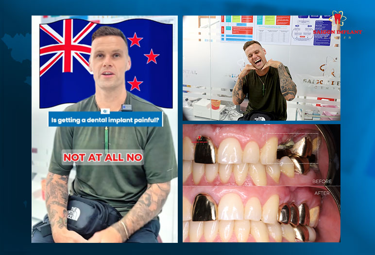Gentle and Painless Dental Implants in Ho Chi Minh City